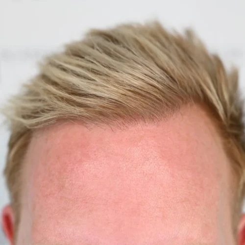 efter2